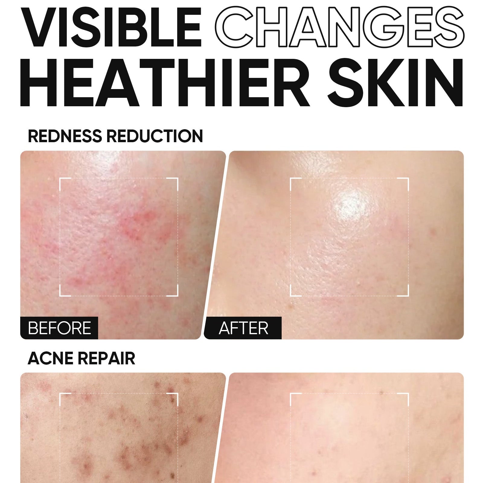 Lip Serum + Cover Cushion + 5X Ceramide Barrier