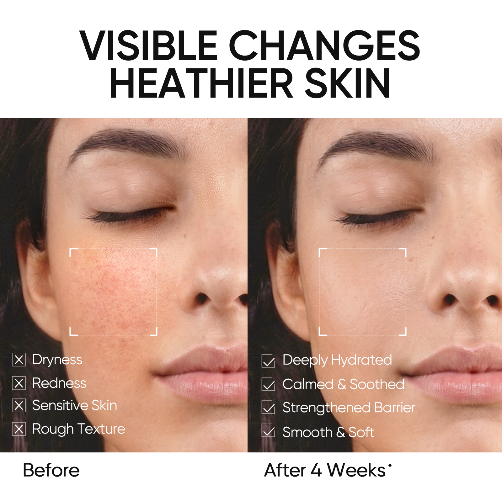 5X Ceramide Moisturizer & SPF50 Sunscreen Set
