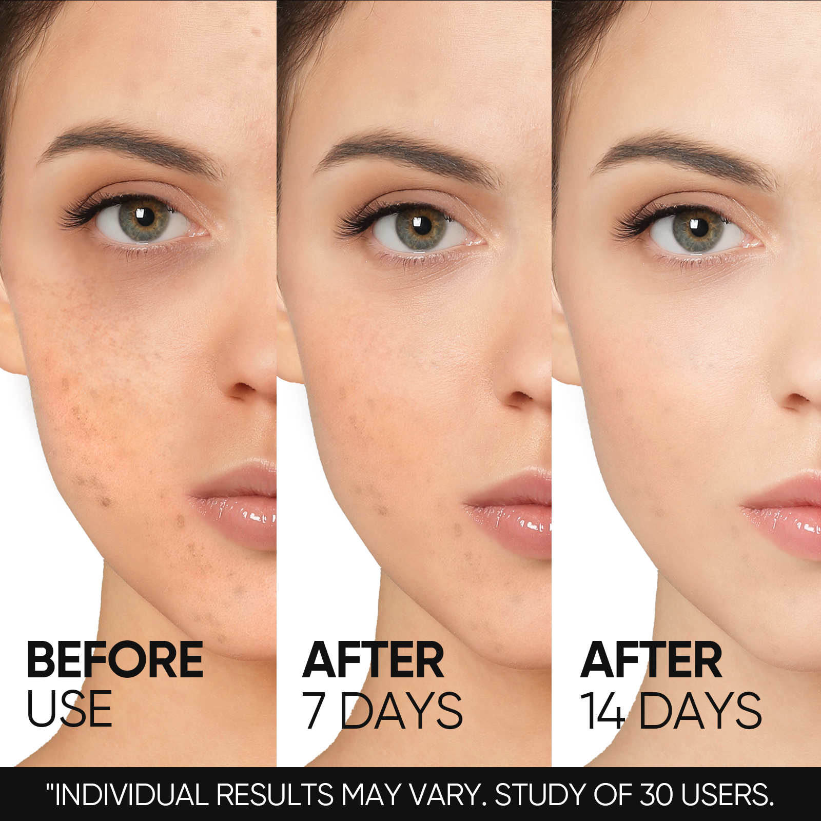 10% Niacinamide Brightening Serum