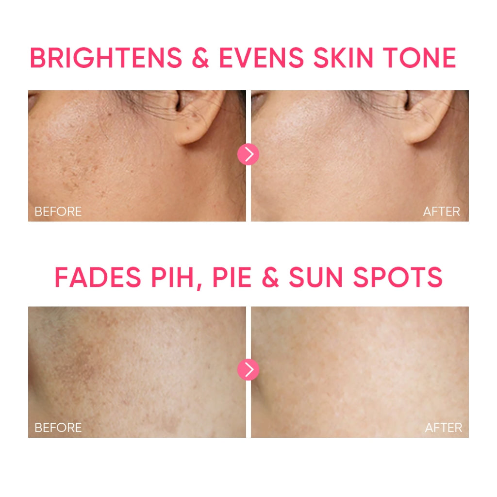 MSH Niacinamide Brightening Moisture Gel (Mini Sample)