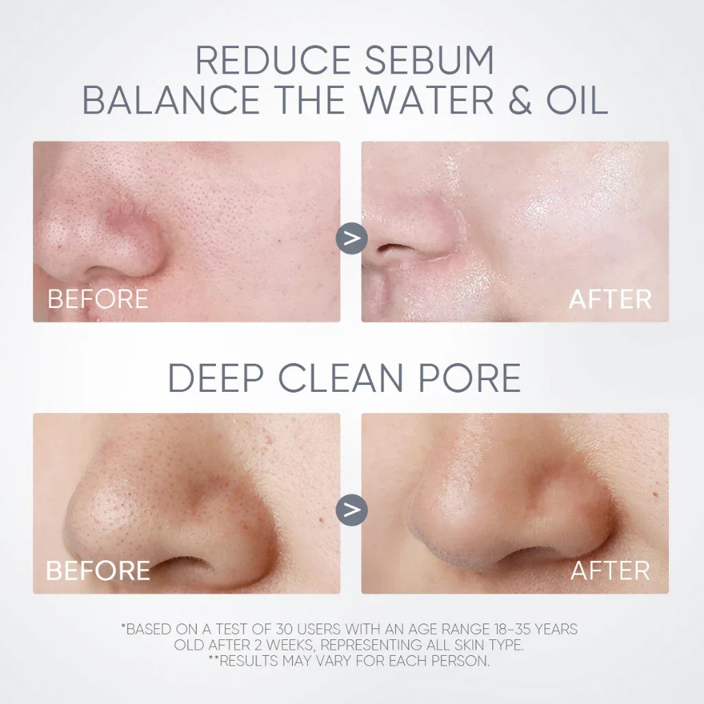 Alaska Volcano Blackhead Cleansing Mask Stick