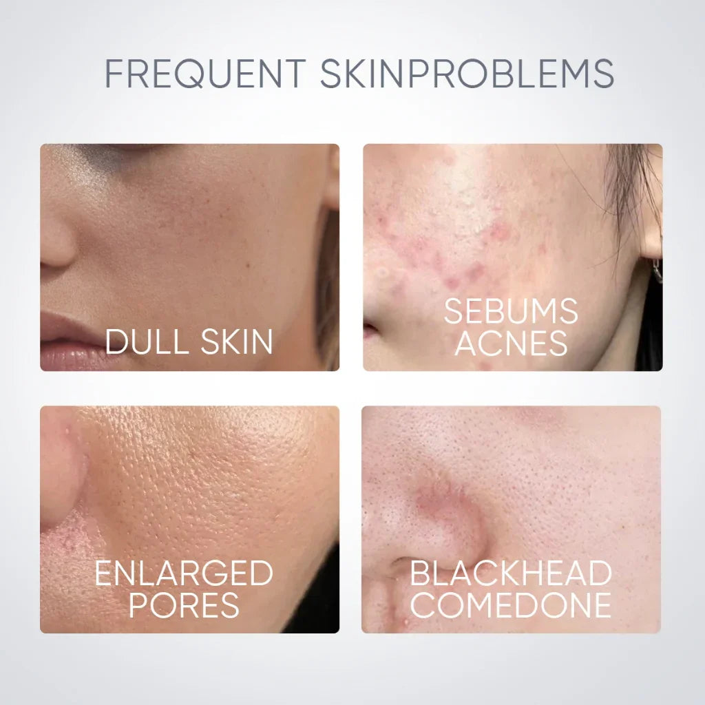 Alaska Volcano Blackhead Cleansing Mask Stick