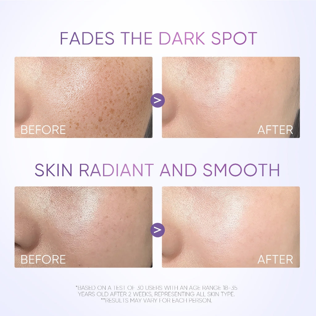 SymWhite 377 Dark Spot Eraser Serum