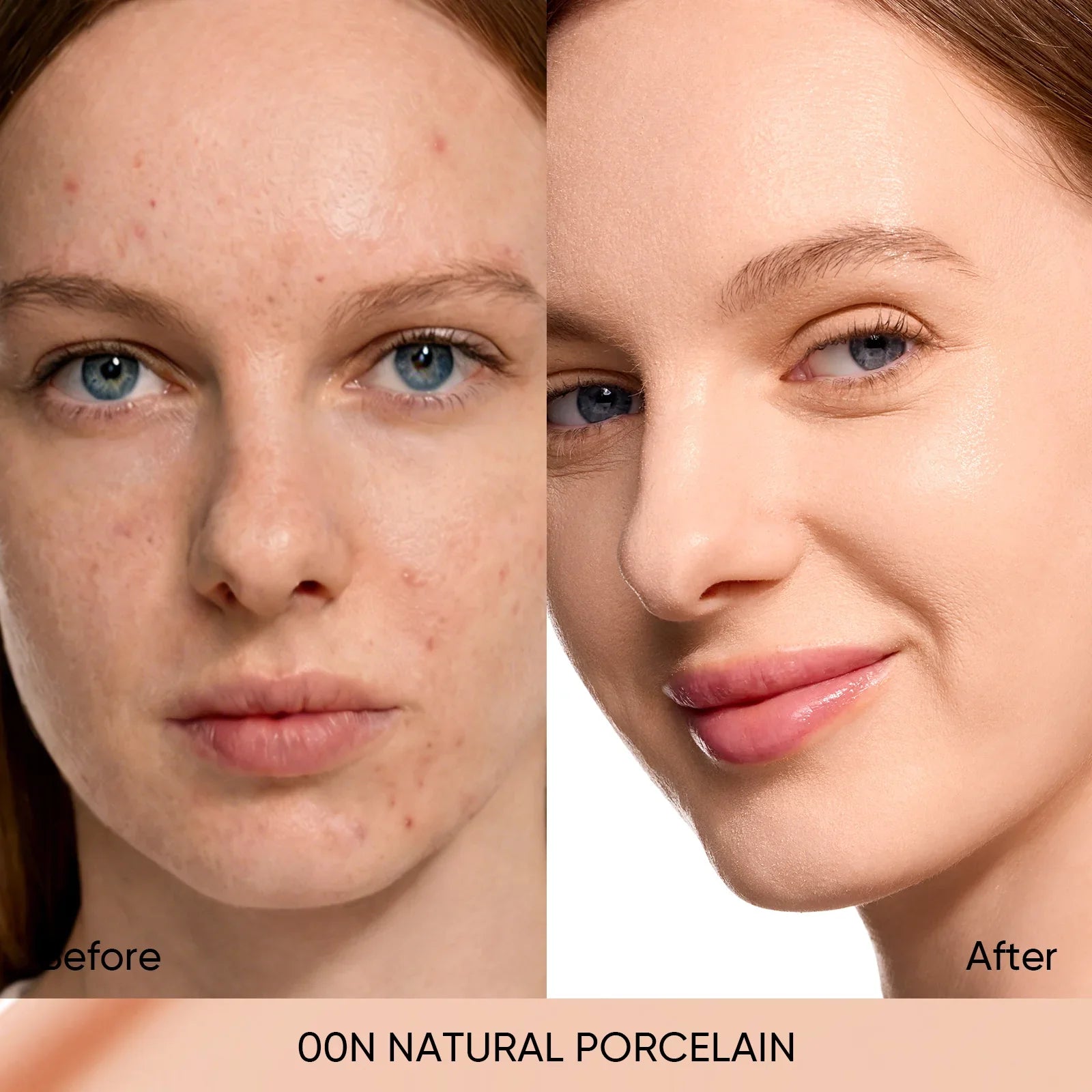 #Color_00N   Natural Porcelain