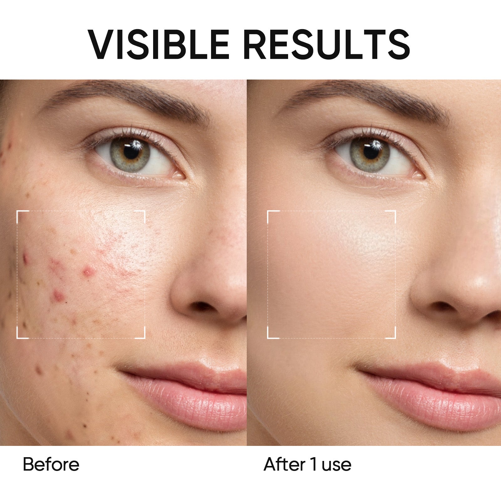 Mugwort Anti Pores & Acne Clay Mask Stick