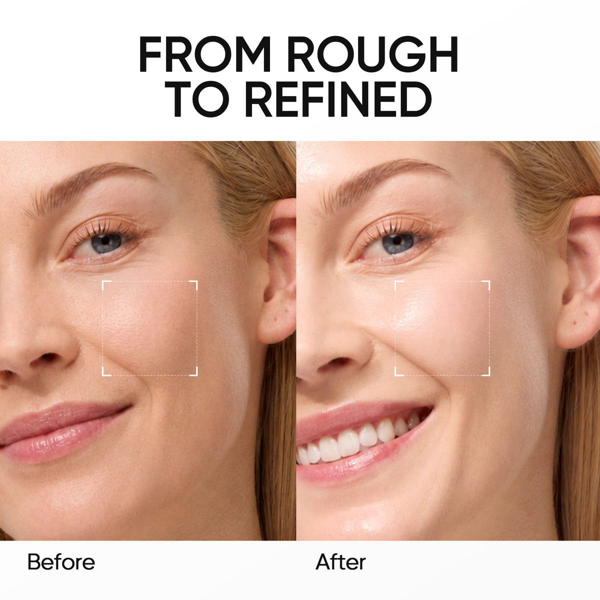 AHA BHA PHA Skin Resurfacing Clay Stick