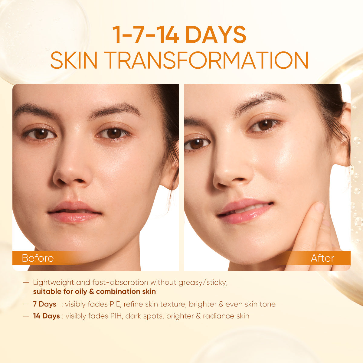 Vitamin C Brightening Set 4pcs Kit - Brightening Cleanser, Toner, Serum & Moisturizer - Dark Spot & Glow Solution