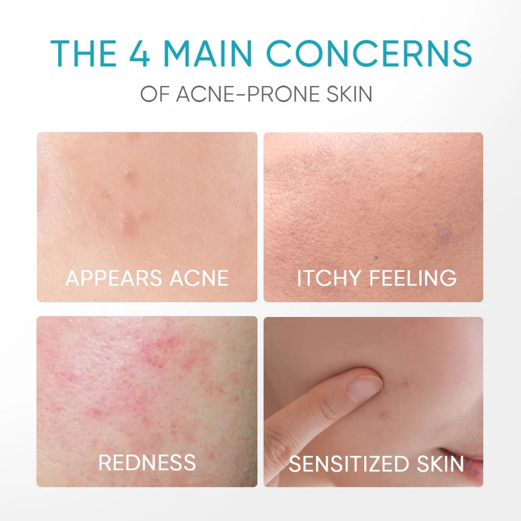 5% Panthenol Acne Calming Water Gel